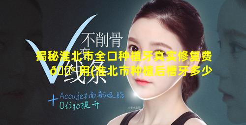 揭秘淮北市全口种植牙真实修复费 💮 用(淮北市种植后槽牙多少钱一颗)